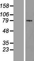S100G Human Over-expression Lysates NM_004057