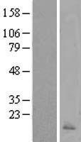 Calcitonin (CALCA) Human Over-expression Lysates NM_001033952