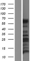 ls000799 calcitonin receptor calcr human over expression lysates nm 001164737 wb testing 1