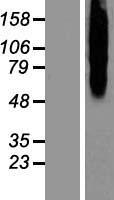 ls000799 calcitonin receptor calcr human over expression lysates nm 001164738 wb testing 3