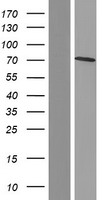 Caldesmon (CALD1) Human Over-expression Lysates NM_033139