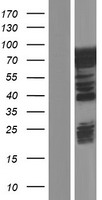 Caldesmon (CALD1) Human Over-expression Lysates NM_033157
