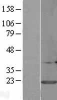 CALM3 Human Over-expression Lysates NM_005184