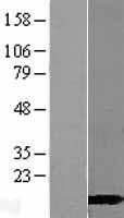 CALML3 Human Over-expression Lysates NM_005185