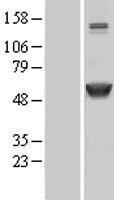 CAMK2A Human Over-expression Lysates NM_171825