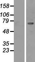 ls000816 camk2b human over expression lysates nm 001220 wb testing 1