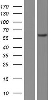 ls000816 camk2b human over expression lysates nm 172079 wb testing 6