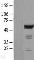 CAMK2D Human Over-expression Lysates NM_172128