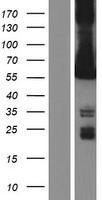 CAMK2G Human Over-expression Lysates NM_001222