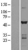 CAMK2G Human Over-expression Lysates NM_172169