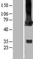 CAMK2G Human Over-expression Lysates NM_172170