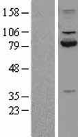 Calpain 2 (CAPN2) Human Over-expression Lysates NM_001748