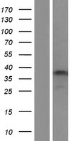 Calpain 3 (CAPN3) Human Over-expression Lysates NM_173088