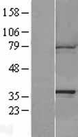 CAPZA1 Human Over-expression Lysates NM_006135