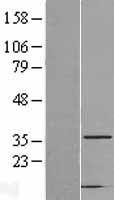 CAPZA2 Human Over-expression Lysates NM_006136