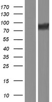 Calpastatin (CAST) Human Over-expression Lysates NM_001042444