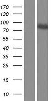 Calpastatin (CAST) Human Over-expression Lysates NM_001190442