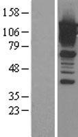 Calpastatin (CAST) Human Over-expression Lysates NM_001750