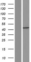 Caspase 1 (CASP1) Human Over-expression Lysates NM_001223