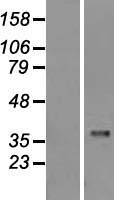 Caspase 1 (CASP1) Human Over-expression Lysates NM_033293