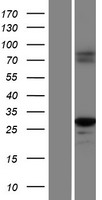 Caspase 1 (CASP1) Human Over-expression Lysates NM_033294