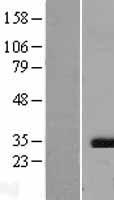 Caspase 3 (CASP3) Human Over-expression Lysates NM_004346