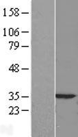 Caspase 3 (CASP3) Human Over-expression Lysates NM_032991