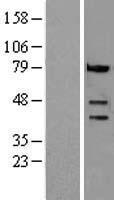 Caspase 4 (CASP4) Human Over-expression Lysates NM_001225