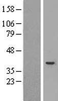 Caspase 4 (CASP4) Human Over-expression Lysates NM_033306