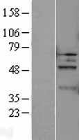 Caspase 5 (CASP5) Human Over-expression Lysates NM_004347