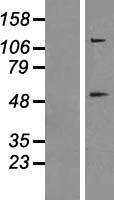 Caspase 8 (CASP8) Human Over-expression Lysates NM_001228