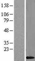 Caspase 8 (CASP8) Human Over-expression Lysates NM_033355