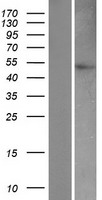 Caspase 9 (CASP9) Human Over-expression Lysates NM_001229