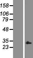 Caspase 9 (CASP9) Human Over-expression Lysates NM_032996