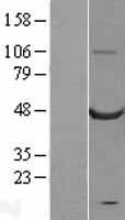 CASQ2 Human Over-expression Lysates NM_001232