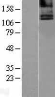 ls000846 calcium sensing receptor casr human over expression lysates nm 000388 wb testing 1