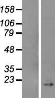 Caveolin 1 (CAV1) Human Over-expression Lysates NM_001753
