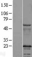 Caveolin 2 (CAV2) Human Over-expression Lysates NM_001233