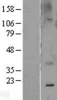 Caveolin 2 (CAV2) Human Over-expression Lysates NM_198212