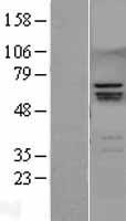 RUNX2 Human Over-expression Lysates NM_001024630