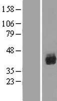 RUNX1 Human Over-expression Lysates NM_001001890