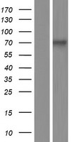 RUNX1T1 Human Over-expression Lysates NM_175634