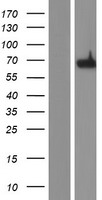 CBFA2T3 Human Over-expression Lysates NM_175931