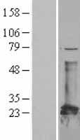 CBFB Human Over-expression Lysates NM_001755