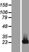 CBFB Human Over-expression Lysates NM_022845