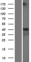 SERPINA6 Human Over-expression Lysates NM_001756