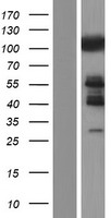 CBL Human Over-expression Lysates NM_005188