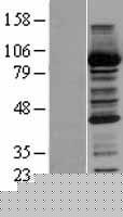 CBR1 Human Over-expression Lysates NM_001757