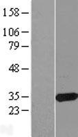 CBR3 Human Over-expression Lysates NM_001236