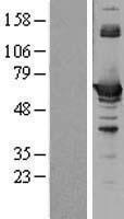 CBS Human Over-expression Lysates NM_000071